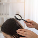 close-up-woman-with-dandruff-doctor